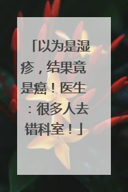 以为是湿疹，结果竟是癌！医生：很多人去错科室！